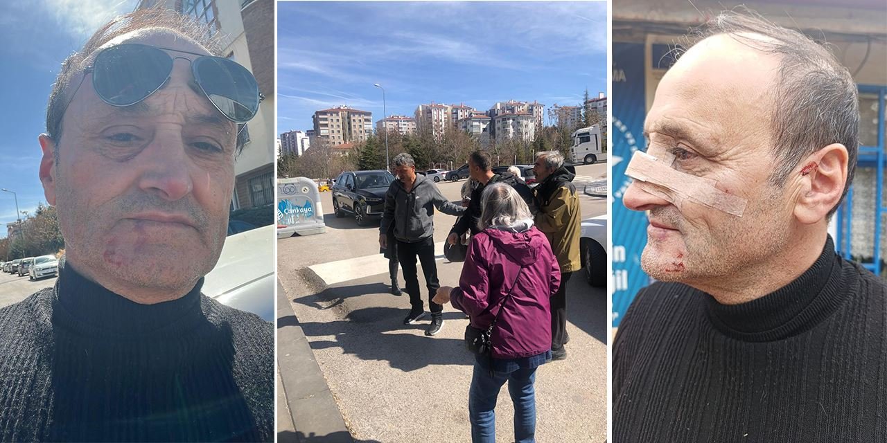 Ankara'da eylemde şiddet: Bir kişinin burnu kırıldı
