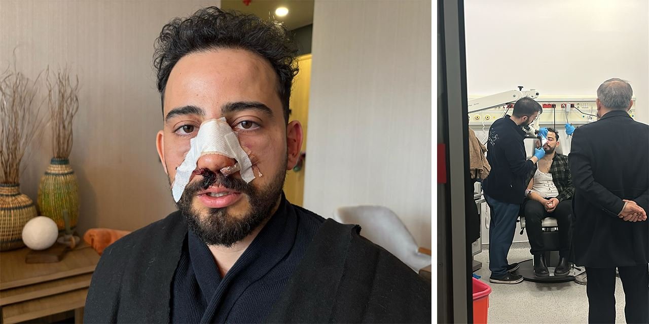 Restoranda sipariş krizi: Müşteri darp edildi
