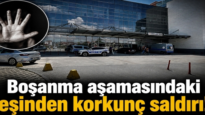 Boşanma aşamasındaki eşinden korkunç saldırı!