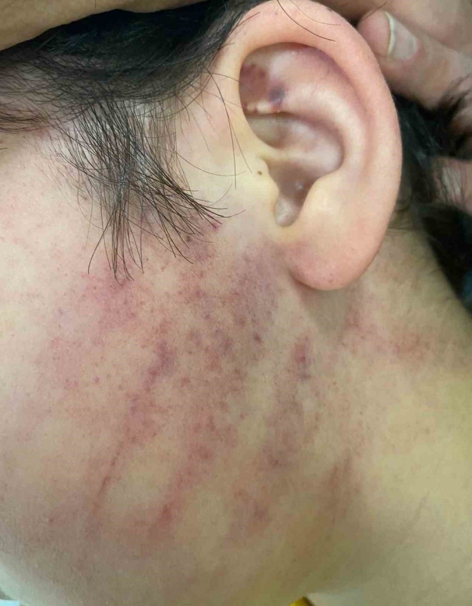 Okul sırası kavgası kanlı bitti: Fırça sapı silah sayıldı, aileler hapis cezasıyla yargılanacak 2