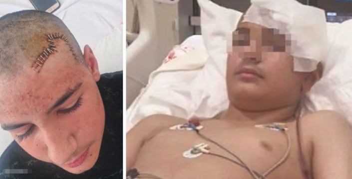 Konya’da akran şiddeti: 13 yaşındaki çocuğun kafasını taşla ezdi