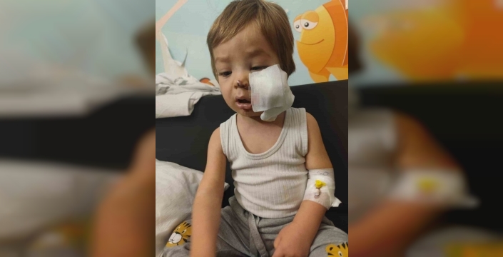 Ankara'da pitbull saldırısına uğrayan çocukların babası: