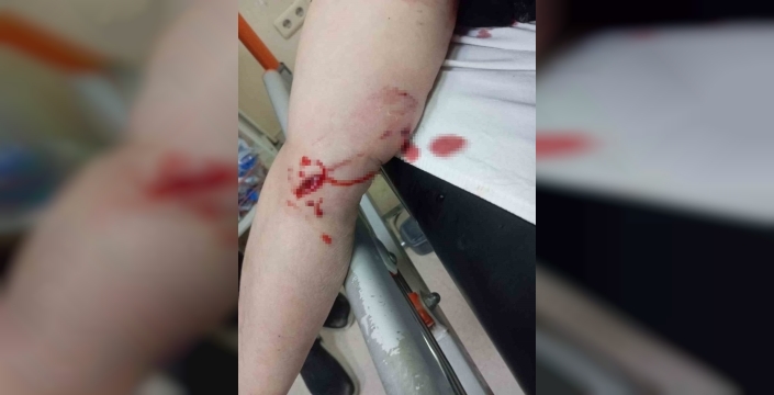 Şırnak'ta dehşet anları: Sokak köpekleri 3 kadını kana buladı