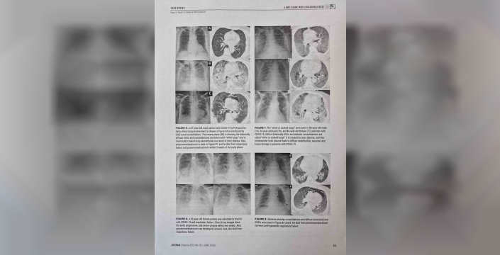 Covid-19'un ölüm haritası çıkarıldı: Salgınların geleceği için kritik bulgular