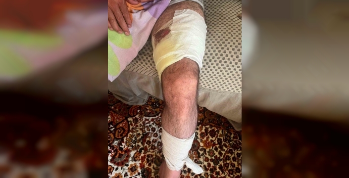 Muradiye'de akrabalar arası arazi kavgası kan aktırdı: Bir kişi yaralandı