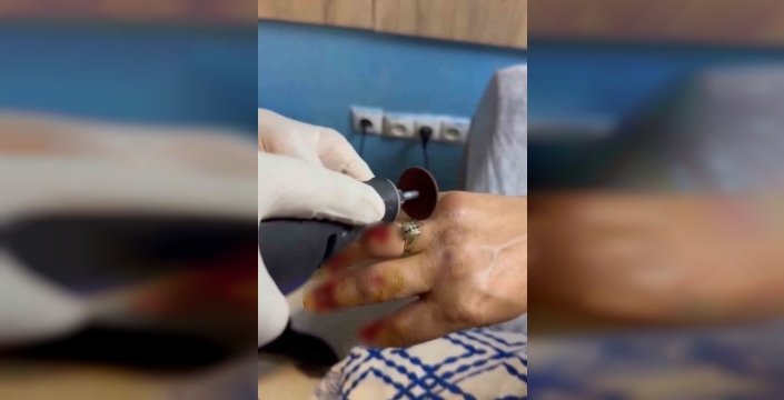 Van'da kaza sonrası sıkışan yüzük, itfaiye ekipleri tarafından çıkarıldı